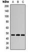 Aurora A antibody, orb304692, Biorbyt, Western Blot image 