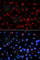 Serine And Arginine Rich Splicing Factor 1 antibody, A1649, ABclonal Technology, Immunofluorescence image 