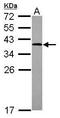 Low Density Lipoprotein Receptor Adaptor Protein 1 antibody, PA5-30505, Invitrogen Antibodies, Western Blot image 