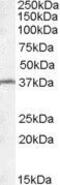 Radial Spoke Head Component 1 antibody, GTX88743, GeneTex, Western Blot image 