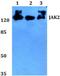 Janus Kinase 2 antibody, GTX66678, GeneTex, Western Blot image 