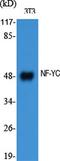 Nuclear Transcription Factor Y Subunit Gamma antibody, A06128, Boster Biological Technology, Western Blot image 