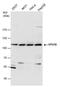 VPS18 Core Subunit Of CORVET And HOPS Complexes antibody, PA5-78546, Invitrogen Antibodies, Western Blot image 