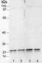 Caveolin 1 antibody, TA301445, Origene, Western Blot image 