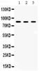 Aconitase antibody, PB9973, Boster Biological Technology, Western Blot image 