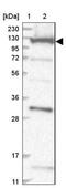 Conserved oligomeric Golgi complex subunit 1 antibody, NBP1-81414, Novus Biologicals, Western Blot image 