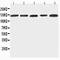 Integrin Subunit Alpha 7 antibody, PA2226, Boster Biological Technology, Western Blot image 