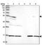 Aspartyl Aminopeptidase antibody, PA5-60848, Invitrogen Antibodies, Western Blot image 