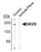 Glutamate Ionotropic Receptor NMDA Type Subunit 2B antibody, NB300-295, Novus Biologicals, Western Blot image 