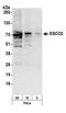 Establishment Of Sister Chromatid Cohesion N-Acetyltransferase 2 antibody, A301-689A, Bethyl Labs, Western Blot image 