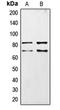 Choline O-Acetyltransferase antibody, orb213729, Biorbyt, Western Blot image 