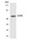 Gastric Inhibitory Polypeptide Receptor antibody, LS-C291992, Lifespan Biosciences, Western Blot image 