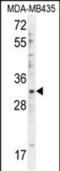 DTW Domain Containing 1 antibody, PA5-48228, Invitrogen Antibodies, Western Blot image 