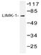 LIM Domain Kinase 1 antibody, AP20386PU-N, Origene, Western Blot image 