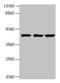 Mitochondrial Ribosomal Protein S31 antibody, CSB-PA846089LA01HU, Cusabio, Western Blot image 