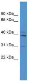 T-Box 10 antibody, TA331100, Origene, Western Blot image 
