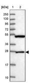 AC104809.3 antibody, NBP2-14651, Novus Biologicals, Western Blot image 