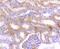 CPT2 antibody, NBP2-67699, Novus Biologicals, Immunohistochemistry paraffin image 