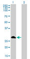 Four And A Half LIM Domains 1 antibody, LS-C197221, Lifespan Biosciences, Western Blot image 