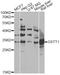 Glutathione S-Transferase Theta 1 antibody, LS-C749011, Lifespan Biosciences, Western Blot image 