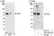 Abl interactor 2 antibody, A302-499A, Bethyl Labs, Western Blot image 