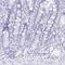 Parotid secretory protein antibody, NBP1-91704, Novus Biologicals, Immunohistochemistry paraffin image 