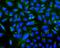 UDP Glucuronosyltransferase Family 1 Member A6 antibody, A02239-1, Boster Biological Technology, Western Blot image 
