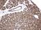 Keratin 8 antibody, LS-C796666, Lifespan Biosciences, Immunohistochemistry paraffin image 