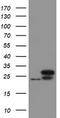 Ubiquitin Conjugating Enzyme E2 E3 antibody, TA800057AM, Origene, Western Blot image 