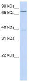 Chromosome 17 Open Reading Frame 80 antibody, TA342049, Origene, Western Blot image 