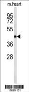Cyclin Dependent Kinase 19 antibody, 63-774, ProSci, Western Blot image 