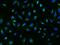 Signal Peptide Peptidase Like 2A antibody, 207237-T02, Sino Biological, Immunohistochemistry paraffin image 