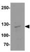 Janus Kinase 2 antibody, GTX31943, GeneTex, Western Blot image 