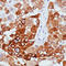 Melan-A antibody, LS-C88285, Lifespan Biosciences, Immunohistochemistry paraffin image 