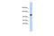 U2 SnRNP Associated SURP Domain Containing antibody, 25-679, ProSci, Western Blot image 