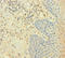 Capping Actin Protein Of Muscle Z-Line Subunit Alpha 2 antibody, orb350329, Biorbyt, Immunohistochemistry paraffin image 
