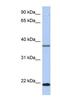 HD Domain Containing 3 antibody, NBP1-56806, Novus Biologicals, Western Blot image 