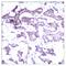 ETS domain-containing protein Elk-1 antibody, A01426, Boster Biological Technology, Immunohistochemistry paraffin image 