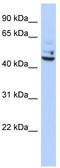 Tumor Protein P53 Inducible Protein 13 antibody, TA339909, Origene, Western Blot image 