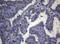 Cathepsin L1 antibody, LS-C794882, Lifespan Biosciences, Immunohistochemistry paraffin image 