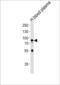 Neuregulin 3 antibody, 62-187, ProSci, Western Blot image 