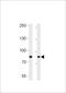 Ubiquitin Specific Peptidase 51 antibody, A13844-1, Boster Biological Technology, Western Blot image 