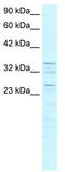 Zinc Finger Protein 385A antibody, TA329420, Origene, Western Blot image 
