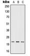 Interferon Omega 1 antibody, MBS822103, MyBioSource, Western Blot image 