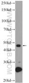 Zinc Finger Protein 506 antibody, 25481-1-AP, Proteintech Group, Western Blot image 