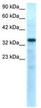 T-Box 10 antibody, TA329732, Origene, Western Blot image 