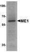 Malic Enzyme 1 antibody, A03449, Boster Biological Technology, Western Blot image 