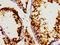 Deoxyhypusine Synthase antibody, LS-C671945, Lifespan Biosciences, Immunohistochemistry paraffin image 