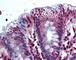 Aldo-Keto Reductase Family 1 Member B10 antibody, 49-259, ProSci, Immunohistochemistry frozen image 