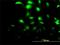 Chloride Intracellular Channel 3 antibody, H00009022-M02, Novus Biologicals, Immunocytochemistry image 
